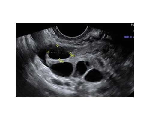 长沙代孕价格哪家好,长沙哪家医院有卵子库？附供卵试管助孕机构一览！