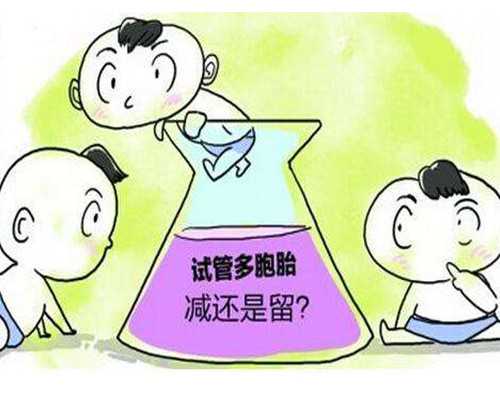 产妇垫巾的使用方法（产后注意事项）