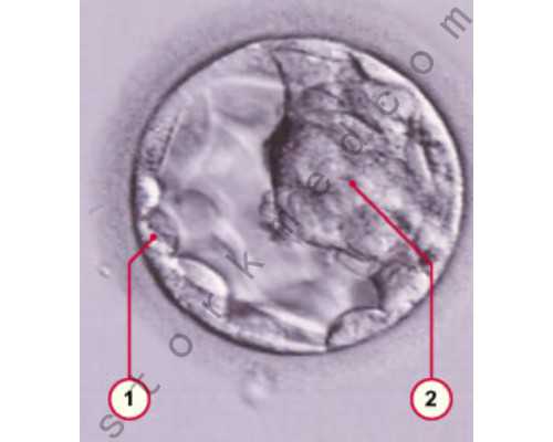 长沙代生男孩贵吗,长沙中信湘雅医院做试管婴儿费用多少钱？听说要20万是真的