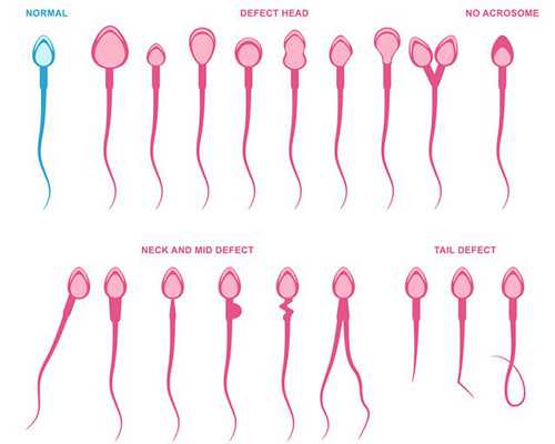 精细运动落后就是脑发育迟缓