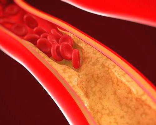长沙代生宝宝咨询,2025年到长沙中信湘雅做试管需要提前预约排队吗？