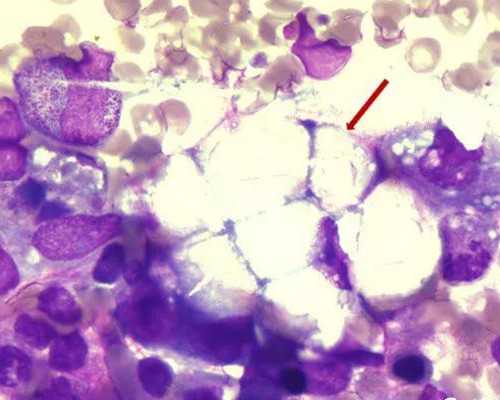 精子总活力低会导致流产吗