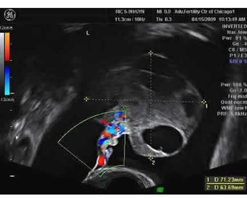 长沙代生哪家安全,2024
年长沙供卵试管费用是多少？