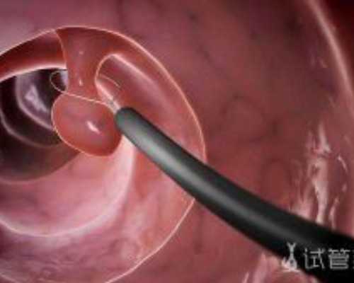 长沙代怀代怀价格,长沙试管婴儿费用大约多少？附价格明细一览表？