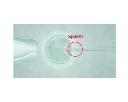 长沙私人供卵试管医院,长沙助孕公司，长沙试管