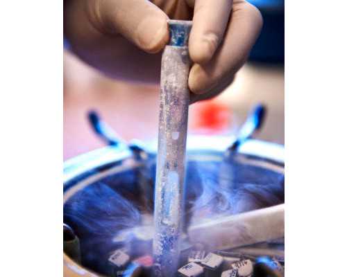 试管费用_三代试管羊穿,定西试管婴儿(什么是试管婴儿)