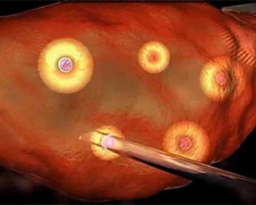 三代试管选y_三代试管胎停,马鞍山试管三代，做第三代试管医院