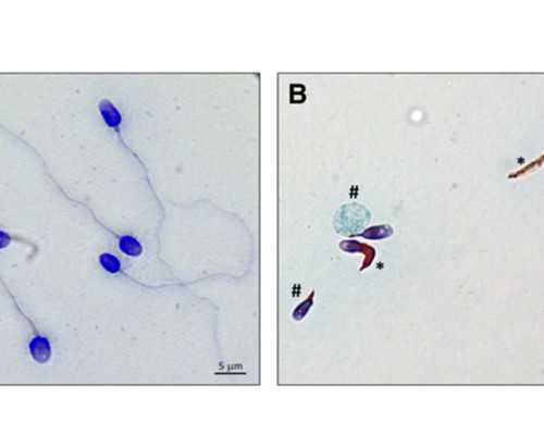 山西试管婴儿所有医院(山西试管婴儿医院排名)