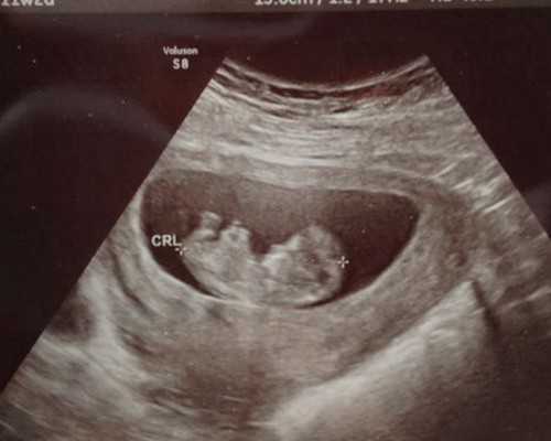 做个试管费用_盛京试管费用,天津试管助孕价格-正规试管中介