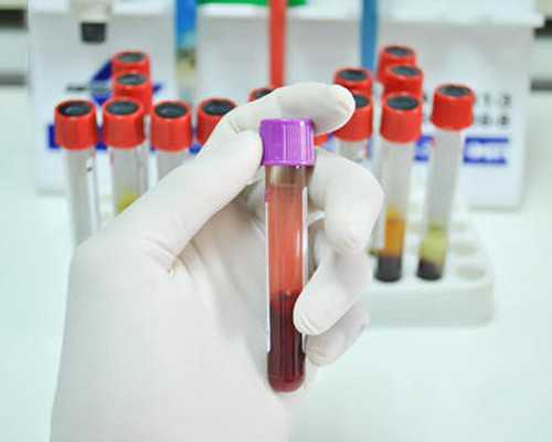 试管供卵来源_一二三代试管,第三代试管晋城哪里能做第三代试管晋城哪里能做