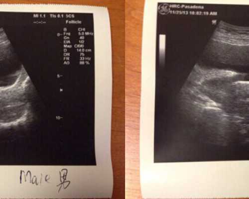 长沙代生中心地址,男性*冷冻保存费用，长沙冷冻*费用明细表