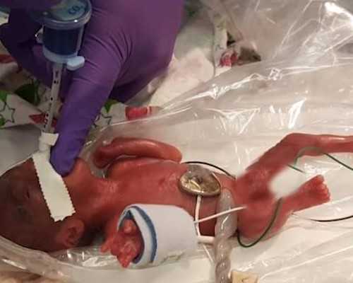 小孩最容易得的心理疾病有哪些？