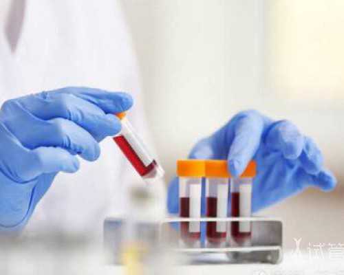 孕晚期如厕的注意事项,孕妇如何选卫生纸