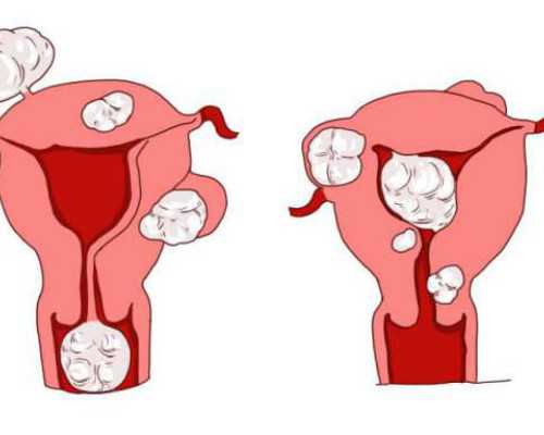 高龄试管供卵_做供卵试管助孕,试管婴儿是在试管里长大的？