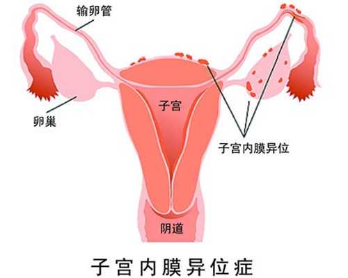 试管捐卵经历_泰国试管费用,试管婴儿网：试管婴儿双胞胎好吗