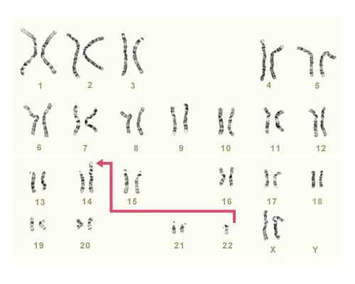 长沙代生正规机构,注意事项：试管婴儿移植后需要卧床休息吗？-上海有没有供
