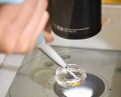 做供卵试管助孕_捐卵做试管了,试管宝宝需要做唐氏筛查吗？试管宝宝做唐筛准