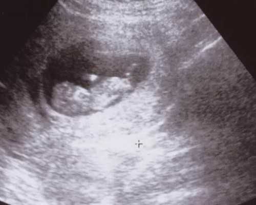 长沙代孕包儿子,长沙有可以做供精三代试管的医院吗？附医院明细！