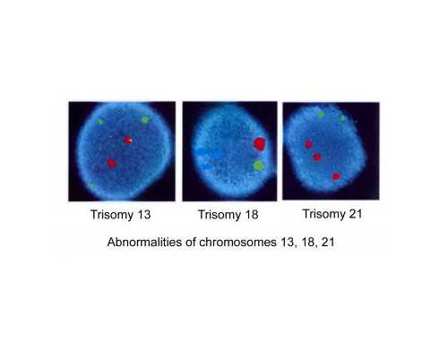 供精试管_做试管费用,试管知识：周口三代试管多少钱.