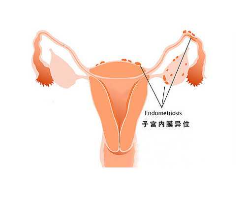 长沙正规代怀价格,长沙男女如何做试管婴儿，同性三代试管的过程和费用