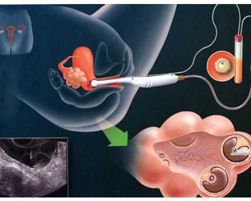 长沙试管供卵助孕多少钱,长沙试管助孕机构!长沙助孕机构排名
