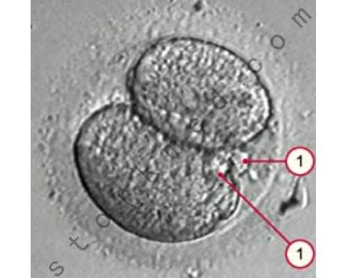 长沙供卵助孕官网网址,长沙供卵试管婴儿_长沙取卵