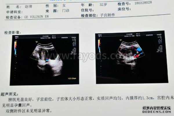 绥棱县捐卵痛不痛_试管移植35天是怀孕几周？通过看孕囊大小标准就知道。